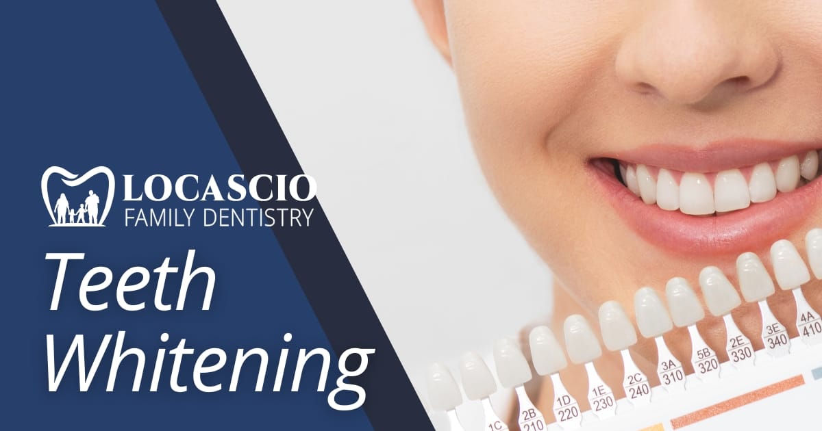 Lo Teeth Dentist Elk Grove — Immediate Results Teeth Whitening