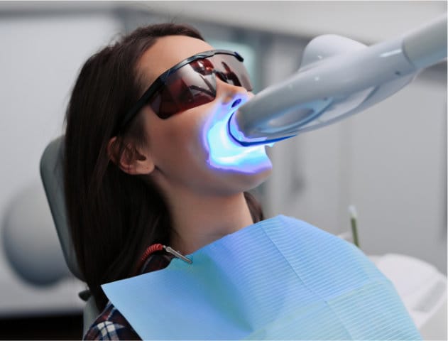 Dentist Elk Grove — Immediate Results Teeth Whitening